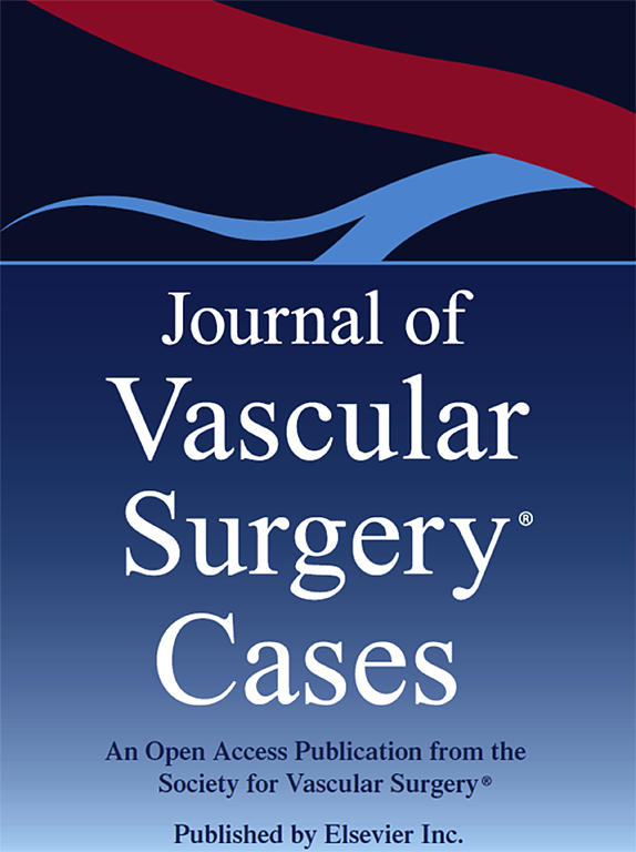 Go to journal home page - Journal of Vascular Surgery Cases